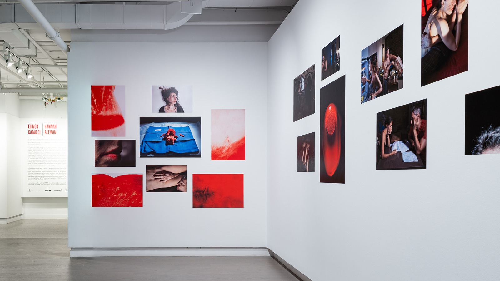 Installation view of Elinor Carucci's photographs